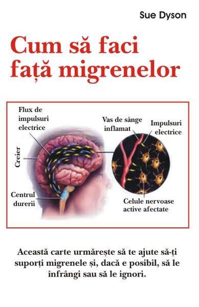 Cum să faci faţă migrenelor - Paperback brosat - Sue Dyson - Antet Revolution